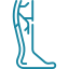 Joint Replacement